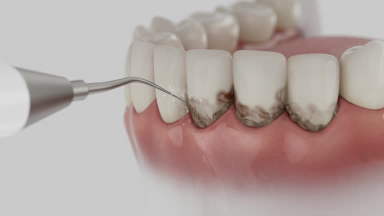 Trusted Teeth Cleaning And Checkup service in Friendswood, TX - Dentist Open Now